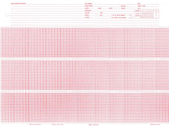 Burdick Compatible 007944 Medical Cardiology Recording Chart Paper, Red Grid, 8.5" x 150', 25 Rolls