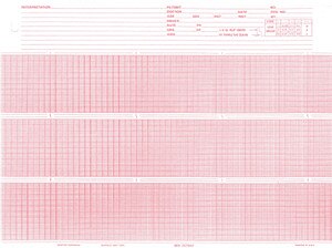 Burdick Compatible 007944 Medical Cardiology Recording Chart Paper, Red Grid, 8.5