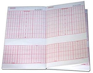 Corometrics Compatible B4305AAO Fetal Recording Chart Paper, Red Grid, Z-Fold, 152mm x 47' - MP-B4305AAO